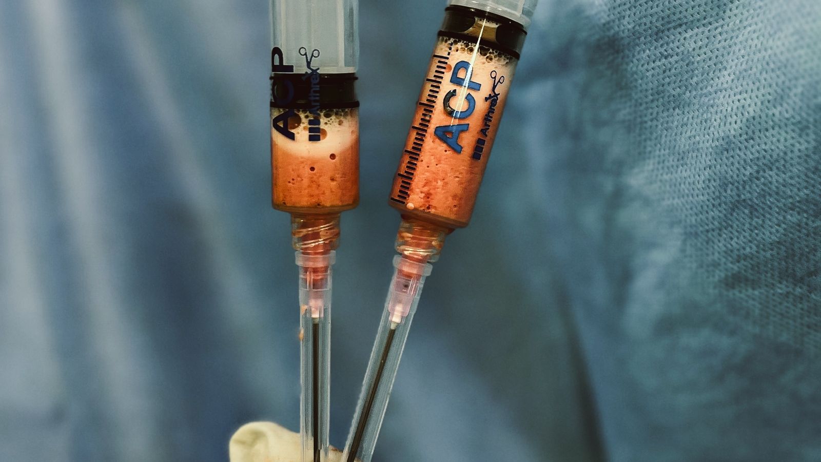 Gloved hands of a surgeon holding two medical syringes during a procedure.